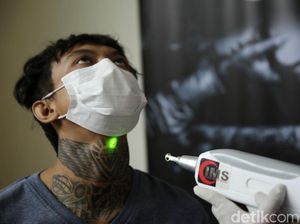 Dapat Hidayah Ramai-ramai Hapus Tato