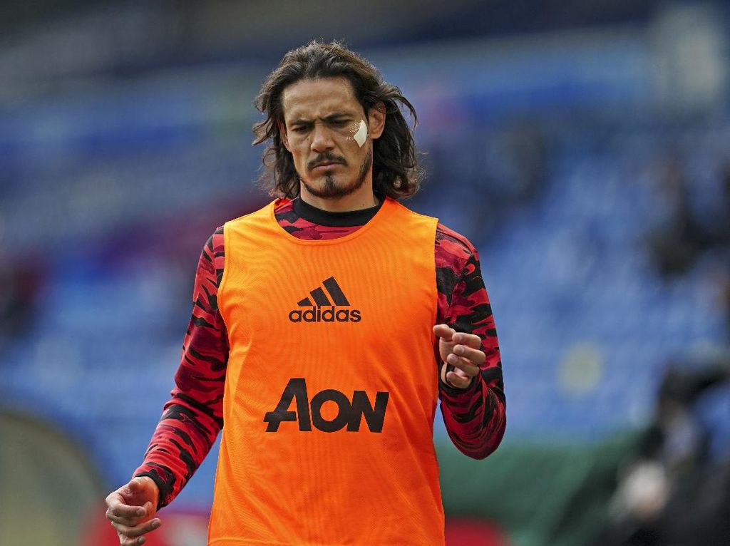 MU Tak Mau Buru-buru Mainkan Edinson Cavani MU Tak Mau Buru-buru Mainkan Edinson Cavani
