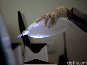 Dosen UGM: GeNose Masih Aktif Digunakan, Tak Ditarik Izin Edarnya Dosen UGM: GeNose Masih Aktif Digunakan, Tak Ditarik Izin Edarnya
