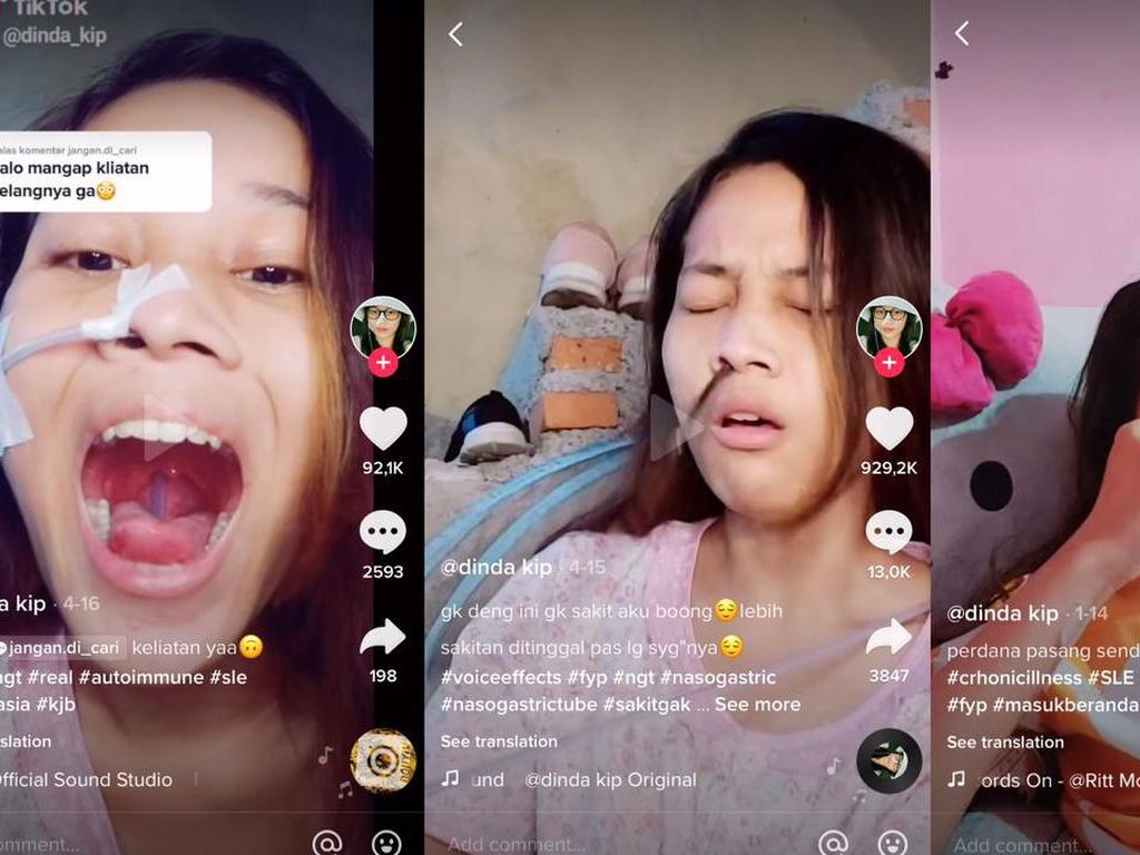 Idap Autoimun, Wanita Ini Bertahun-tahun Makan-minum Pakai Selang Lewat Hidung Idap Autoimun, Wanita Ini Bertahun-tahun Makan-minum Pakai Selang Lewat Hidung