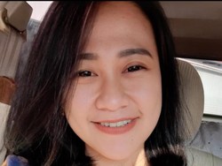 Perawat Cantik yang Dibakar Orang Tak Dikenal Jalani Operasi Ketiga