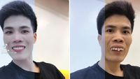 Foto: 8 Transformasi Kocak Pengguna Half Filter yang Viral di TikTok
