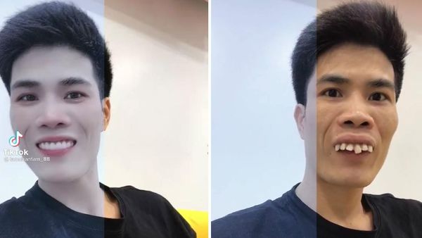 Foto: 8 Transformasi Kocak Pengguna Half Filter yang Viral di TikTok