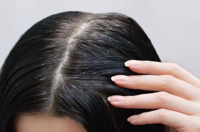 foto: Tips sederhana atasi rambut uban/freepik.com