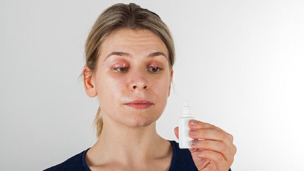 ilustrasi mata bintitan Portrait of a young woman with severe eye infection using medical teardrops - isolated background