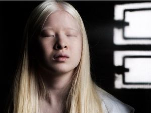 Wanita Albino Ini Dibuang Ortu karena Dianggap Kutukan, Kini Jadi Model Vogue Wanita Albino Ini Dibuang Ortu karena Dianggap Kutukan, Kini Jadi Model Vogue