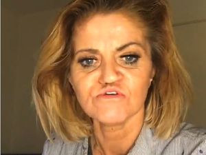 Curhat Wanita yang Di-bully karena Wajah Membusuk Setelah Kecanduan Narkoba