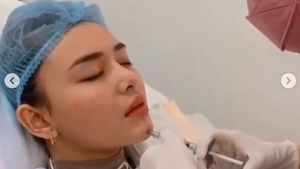 7 Momen Amanda Manopo Suntik Dagu dan Bibir, Bikin Wajah Lebam