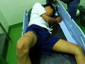 Remaja di Bali Sengaja Tabrakkan Diri ke Mobil yang Melintas