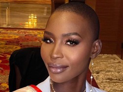 Ratu Kecantikan Di-bully karena Warna Kulit, Disebut Seperti Ayam Gosong