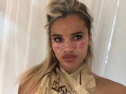 Ikuti DIY Kecantikan dari TikTok, Influencer Ini Berakhir Masuk Rumah Sakit