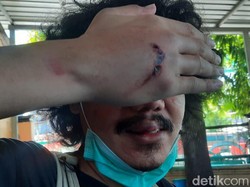 Wartawan Online di Surabaya Jadi Korban Begal Saat Akan Sahur