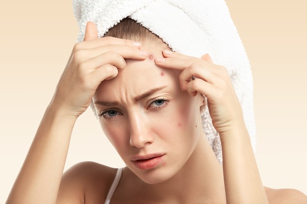 Menghentikan eksfoliasi pada wajah yang berjerwat lebih baik daripada dipaksakan dan menimbulkan iritasi semakin parah.