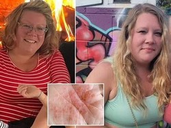 Wanita Ini Turun BB 14 Kg Setelah Rutin Minum Air Kencing