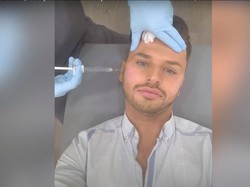 Pria Habiskan Rp 287 Juta Demi Jadi Boneka Ken Dunia Nyata, Begini Hasilnya