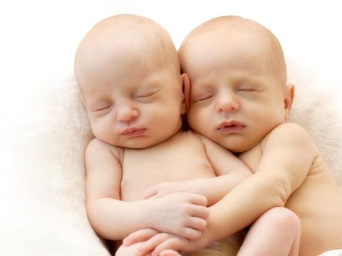 Bayi kembar