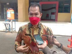 Jumlah Nakes Kena Corona Tambah Jadi 156 Orang, Termasuk Kadinkes