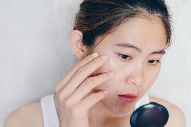 foto: Munculnya jerawat/freepik.com