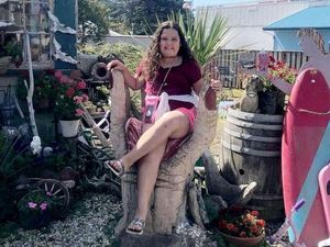 Coba Tantangan TikTok, Gadis Ini Terbakar Hingga Kehilangan Fungsi Tangan Coba Tantangan TikTok, Gadis Ini Terbakar Hingga Kehilangan Fungsi Tangan