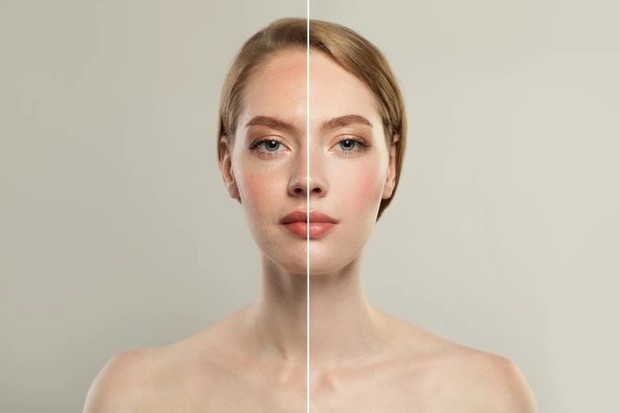 Ilustrasi manfaat retinol/freepik.com Ilustrasi manfaat retinol tidak hanya sebagai anti penuaan/freepik.com