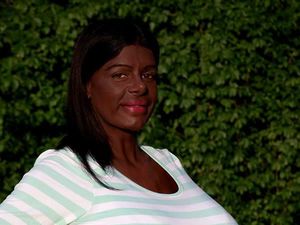 8 Foto Wanita yang Terobsesi Punya Dada Sebesar Titanic, Begini Wujudnya