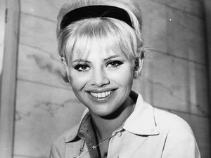 Pengakuan Eks Bond Girl Soal Filler Bibir yang Hancurkan Wajah dan Kariernya