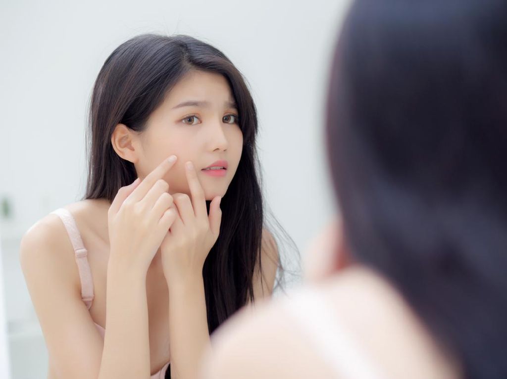 10 Cara Menghilangkan Jerawat Paling Manjur, yang Jelas Nggak Dipencet 10 Cara Menghilangkan Jerawat Paling Manjur, yang Jelas Nggak Dipencet