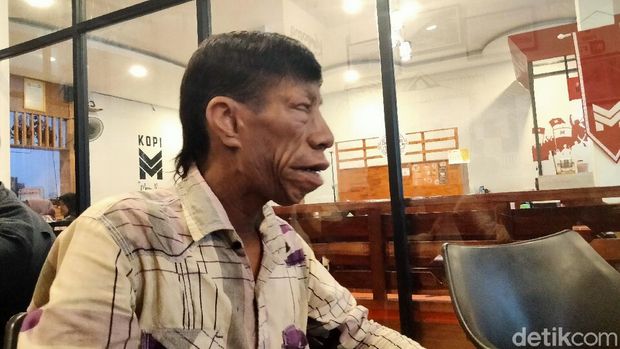 Syarif Surya Manurung (27) pemuda asal Kisaran Timur, Asahan, Sumut viral di medsos karena mengalami kondisi langka Treacher Collins Syndrome (Perdana R/detikcom)