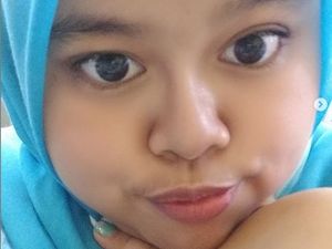 Viral Wajah Kekeyi Bikin Pangling, Ini Cara Memancungkan Hidung Tanpa Operasi Viral Wajah Kekeyi Bikin Pangling, Ini Cara Memancungkan Hidung Tanpa Operasi