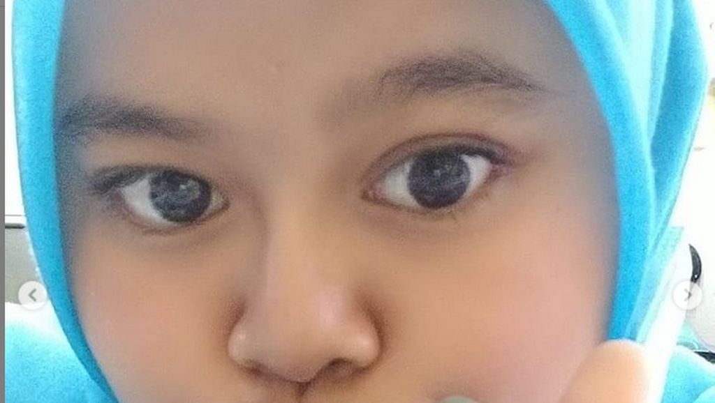 7 Penampilan Kekeyi dengan Hidung Setelah Filler, Foto Before After-nya Viral