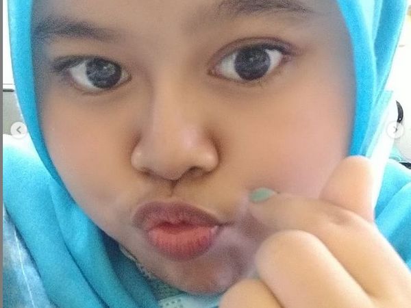7 Penampilan Kekeyi dengan Hidung Setelah Filler, Foto Before After-nya Viral