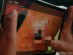 6 Warga Tulungagung Suspect Antraks Tertular dari Sapi