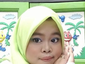 Kekeyi Setelah Filler Hidung: Bisa Tampil Cantik Kekeyi Setelah Filler Hidung: Bisa Tampil Cantik