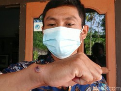 Cerita Kepala Dusun di Tulungagung yang Diduga Terpapar Antraks