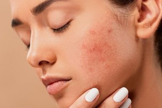 Foto: Kulit kering/freepik.com