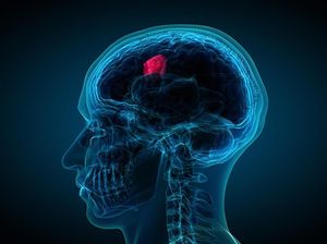 Otak Jadi Lebih Tua Setelah Dilanda Pandemi? Ini Bukti Studinya