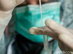 Dear Lab! Ini Pesan Kemenkes soal Kasus-kasus Viral Salah Kirim Hasil PCR