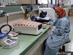 ITD Unair Ungkap Potensi Tanaman Ini Jadi Obat Anti-HIV, Jenis Apa Ya?