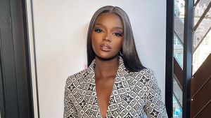 8 Foto Model yang Dapat Komentar Rasis, Dijuluki Kendall Jenner Kulit Hitam