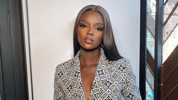 8 Foto Model yang Dapat Komentar Rasis, Dijuluki Kendall Jenner Kulit Hitam