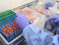 Virus Corona Terus Bermutasi, Akankah Muncul Varian Mahakuat?