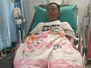 Tubuh Pemuda di Pandeglang Melepuh Gegara Miras, Dinkes: Itu ODGJ