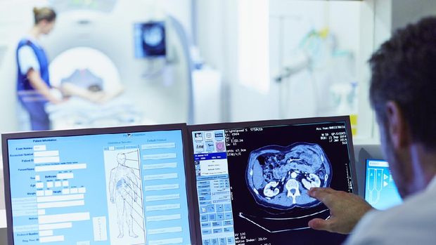 ilustrasi ct scan Faktor risiko demensia