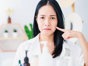 10 Cara Menghilangkan Panu di Muka yang Bikin Nggak Pede