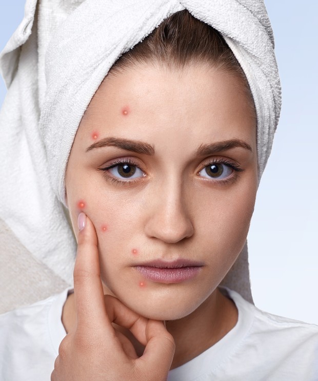 Make up yang tidak dibersihkan menyebabkan jerawat