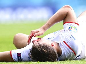 Patrik Schick Berdarah-darah Dulu, Cetak Gol Penalti Kemudian Patrik Schick Berdarah-darah Dulu, Cetak Gol Penalti Kemudian
