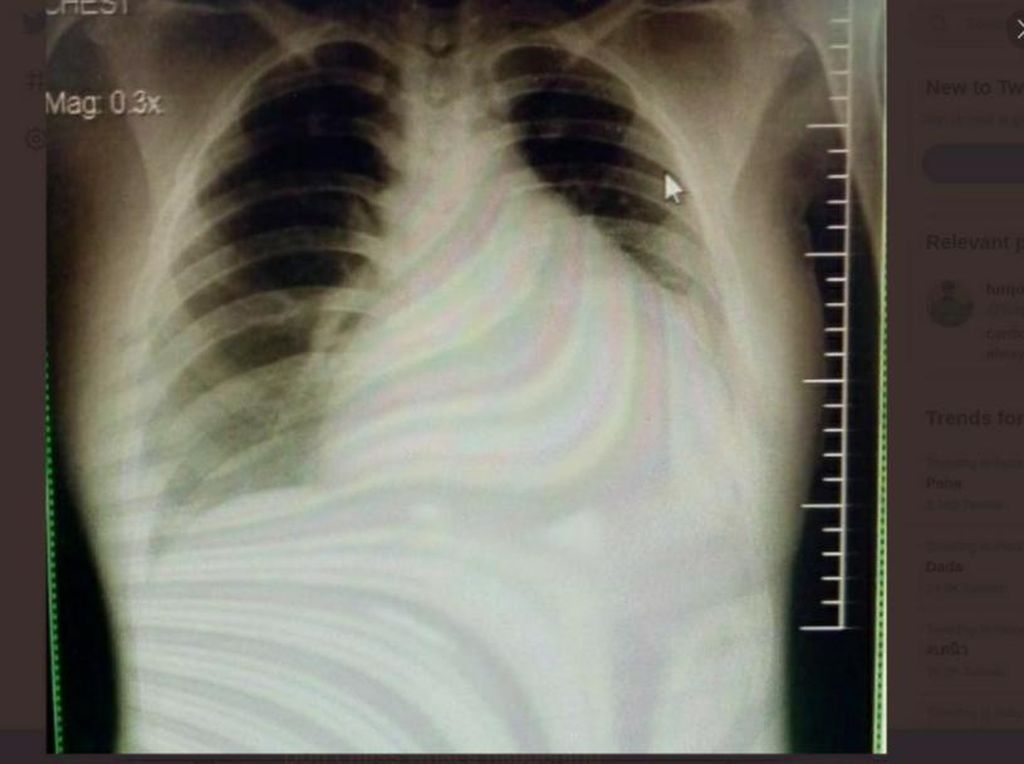 Viral Kisah Pasien Muda Kena Gagal Ginjal-Jantung Gegara Suka Minum Manis Viral Kisah Pasien Muda Kena Gagal Ginjal-Jantung Gegara Suka Minum Manis