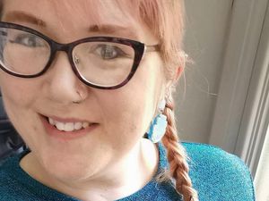 Terapi Antibodi Monoklonal Bisa Selamatkan Nyawa Pasien Corona, Seperti Apa?