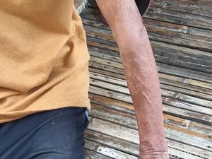 Warga Karawang Terpapar Limbah Pabrik Hanya Dapat Kompensasi Rp 40 Ribu