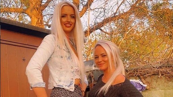 Foto: Penampakan Wanita yang Tingginya 190 Cm, Dulu di-Bully Kini Jadi Sensasi